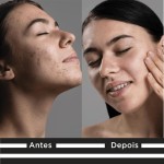 Sérum Facial Antimarcas Clareador Complexo Vitamina C 10 Nanoencapsulada +Ácido Hialurônico +Rosa Mosqueta | Luminosidade, Hidratação, Firmeza e Tom Mais Uniforme | Textura leve e - Imagem 3